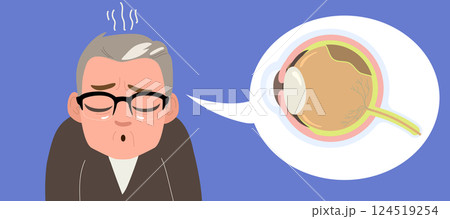 Sad Senior Man Retinal Detachment Vector Illustration 124519254