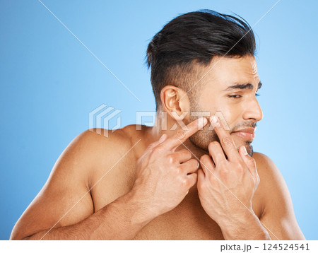 Health, skincare and man popping acne in face with blue background. Mens skin care, morning facial and young guy with flaws, blemish and imperfection pop pimple or blackhead with fingers and hands. Health, skincare and man popping acne in face with blue background. Mens skin care, morning facial and young guy with flaws, blemish and imperfection pop pimple or blackhead with fingers and hands. 124524541