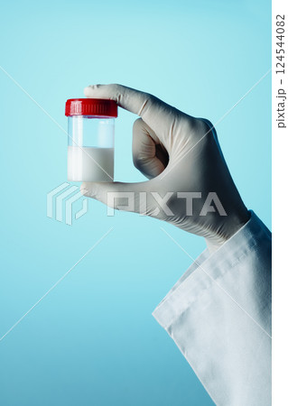 man holds a sterile container with some semen man holds a sterile container with some semen 124544082