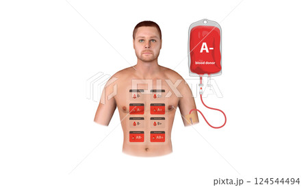 A medical infographic displaying A Negative blood donation, transfusion process, and compatibility with different recipient blood types, 3d 124544494