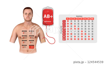 A medical infographic of AB Positive blood donation, illustrating universal recipient properties and transfusion compatibility, 3d A medical infographic of AB Positive blood donation, illustrating universal recipient properties and transfusion compatibility, 3d 124544539