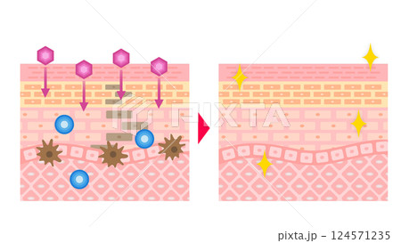 美白ケアの効果イメージ|メラニン抑制と肌の透明感を示す断面図 美白ケアの効果イメージ|メラニン抑制と肌の透明感を示す断面図 124571235
