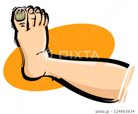 足の爪が割れる 足の爪が割れる 124603634