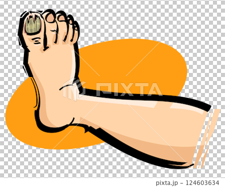 足の爪が割れる 足の爪が割れる 124603634