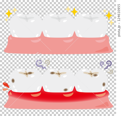 Illustration set of healthy and clean teeth and inflamed unhealthy teeth Illustration set of healthy and clean teeth and inflamed unhealthy teeth 124610955