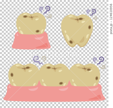 牙齒染色插圖集 牙齒染色插圖集 124610956