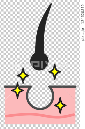 エステで毛根から毛を脱毛して綺麗になるスキンケアのイラスト 124620859