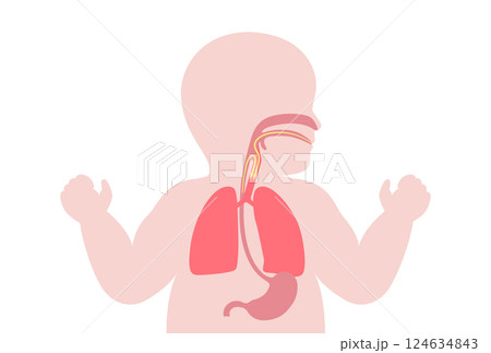 Aspiration pneumonia poster Aspiration pneumonia poster 124634843