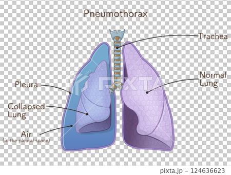 lung, pulmonary, internal organ 124636623
