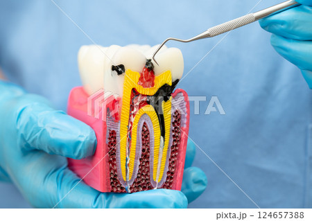Asian dentist holding dental implant, artificial tooth roots into jaw, root canal of dental treatment, gum disease, teeth model for dentist. Asian dentist holding dental implant, artificial tooth roots into jaw, root canal of dental treatment, gum disease, teeth model for dentist. 124657388