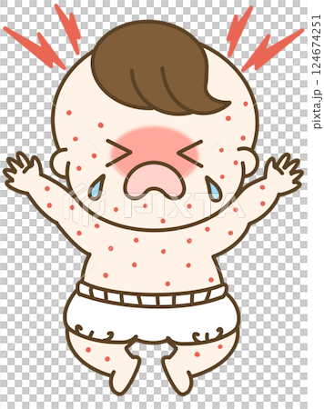 湿疹が出て大泣きしているオムツの男の子の赤ちゃんのゆるかわイラスト 124674251