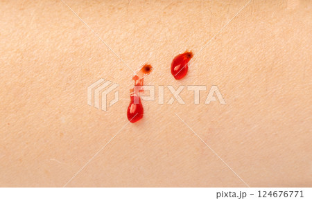 Snake bite on skin, snakebite or cat bite marks close up. Two small fresh blood drops on hand 124676771