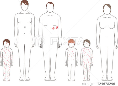 帯状疱疹と水疱瘡。子供と大人の症状のイラスト 124678296