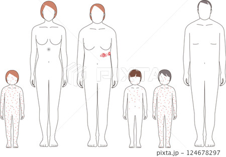 帯状疱疹と水疱瘡。子供と大人の症状のイラスト 帯状疱疹と水疱瘡。子供と大人の症状のイラスト 124678297
