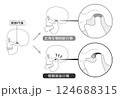顎関節症の症状と説明のイラスト モノトーン 顎関節症の症状と説明のイラスト モノトーン 124688315