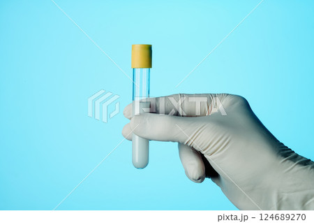 man holds a test tube with some semen 124689270