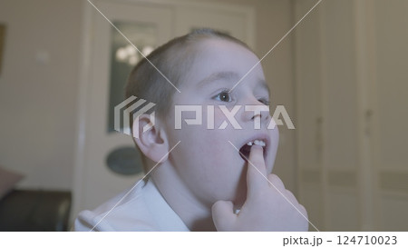 Child Wiggling His Front Milk Teeth. Child Showing His Milk Tooth Before Losing It. Replacement Of Permanent Changing Teeth. 124710023