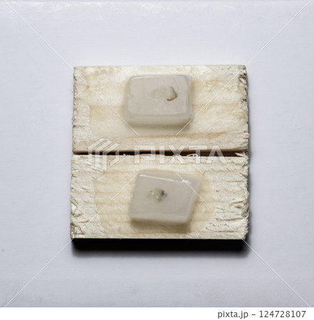 Paraffin blocks with cancer samples, samples for histological examination of the tumor. 124728107
