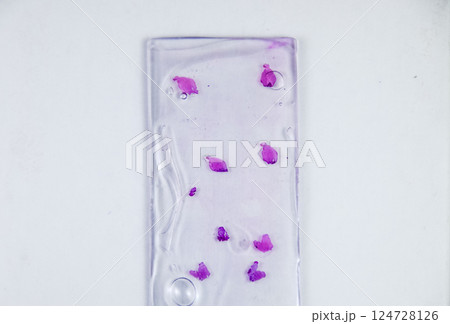 Slices of the tumor under glass. Histological examination of tumor cells for the presence of cancer Slices of the tumor under glass. Histological examination of tumor cells for the presence of cancer 124728126
