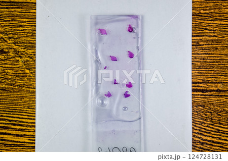 Slices of the tumor under glass. Histological examination of tumor cells for the presence of cancer 124728131