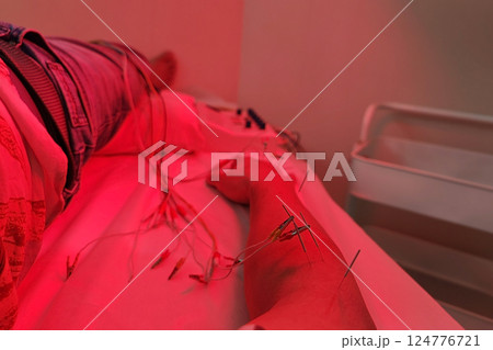 Therapist Giving electric acupuncture therapy via needle 124776721
