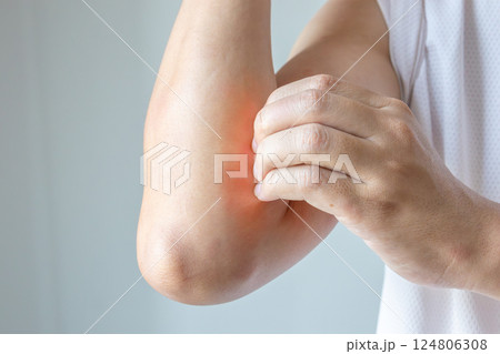 Young asian man itching and scratching on arm from allergic itchy dry skin eczema dermatitis insect bites 124806308
