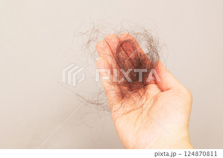 close up photo of female hand holding lost hair in hand on a beige background. 124870811