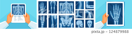 Human Skeleton and X-ray Icon Set. Medical Anatomy Vector Illustrations and Banners Human Skeleton and X-ray Icon Set. Medical Anatomy Vector Illustrations and Banners 124879988
