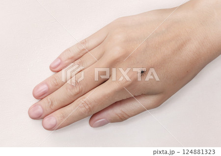 Dangerous tick on a woman hand, close up photo 124881323