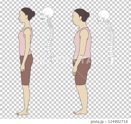 插圖:一位女士側臥的姿勢,包括正確姿勢和錯誤姿勢,以及一個易於理解的骨架 插圖:一位女士側臥的姿勢,包括正確姿勢和錯誤姿勢,以及一個易於理解的骨架 124902718