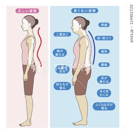 良い姿勢と悪い姿勢の横向き女性と骨格がわかりやすいイラスト 124902720
