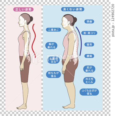 良い姿勢と悪い姿勢の横向き女性と骨格がわかりやすいイラスト 124902720