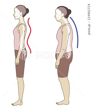 良い姿勢と悪い姿勢の横向き女性と骨格がわかりやすいイラスト 124902724