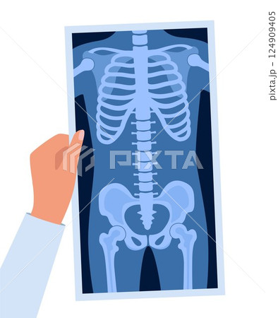 Human skeleton chest x ray image. Torso roentgen shot. Medical analyzing. Anatomical bone medicine laboratory radial scan picture. Roentgen shot in doctors hand. Vector illustration. 124909405
