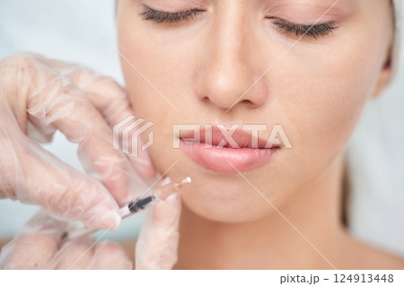 Young caucasian female receiving lip filler injection by gloved hands Young caucasian female receiving lip filler injection by gloved hands 124913448