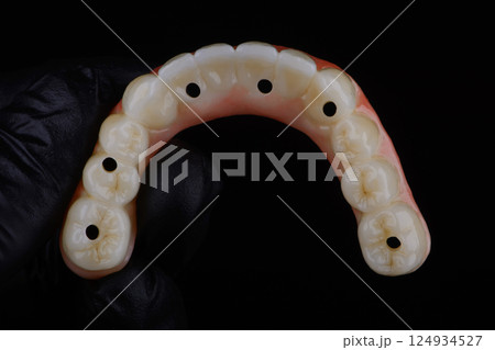 Full dental zirconium prosthesis on titanium bar stained with stains for ceramic 124934527