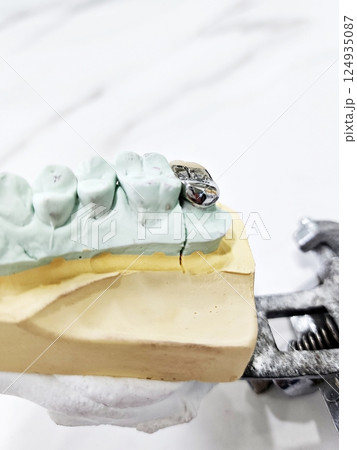 dental PFM crown dental PFM crown 124935087