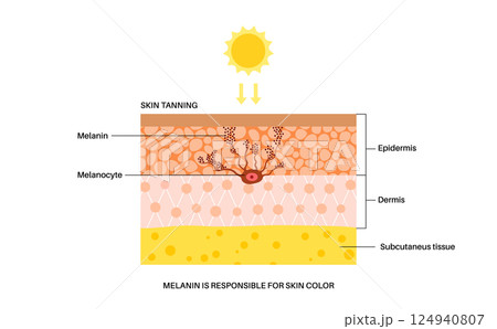 Skin damage from sunburn 124940807