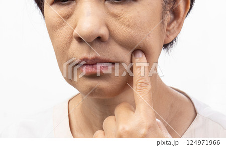 Flabby and wrinkled skin on senior woman face. 124971966