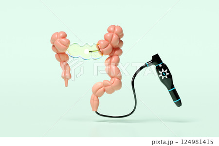 Colonoscopy to find the cause of disease isolated on green background. check digestive, intestine health concept, 3d illustration render 124981415