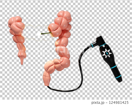 Colonoscopy to find the cause of disease isolated. check digestive, intestine health concept, 3d illustration render 124981425