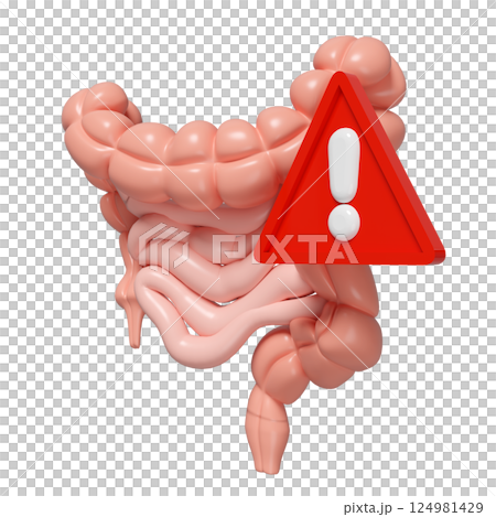 3d Intestines with exclamation mark isolated. danger warning concept, 3d illustration render 124981429