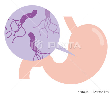 ピロリ菌のイラスト Helicobacter pylori illustration 124984169