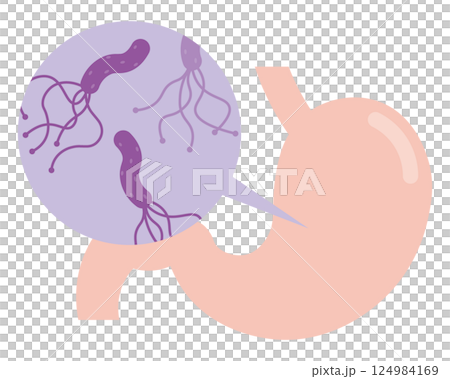 Helicobacter pylori illustration 124984169