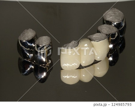 歯科被せ物 124985793
