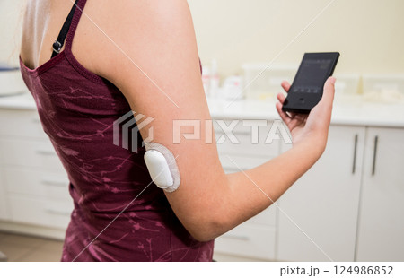 Medical device for glucose check. Continuous glucose monitoring pod.  124986852