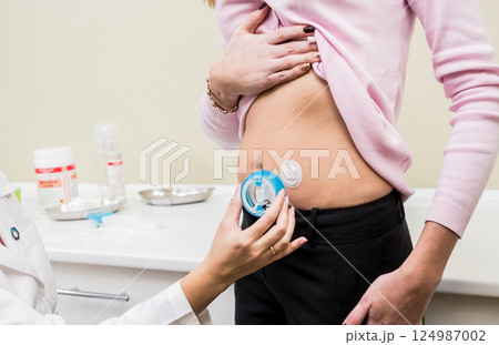Doctor install patient insulin catheter for a simple injection of insulin. Doctor install patient insulin catheter for a simple injection of insulin. 124987002