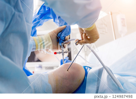 Arthroscope surgery. Orthopedic surgeons in teamwork in the operating room  124987498