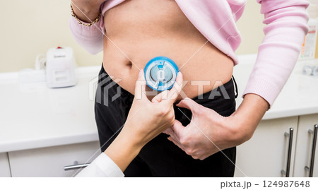 Doctor install patient insulin catheter for a simple injection of insulin. 124987648