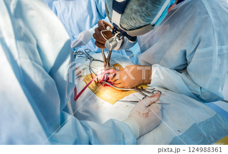 Spinal surgery. Group of surgeons in operating room with surgery equipment.  124988361
